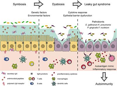 Partners in Leaky Gut Syndrome: Intestinal <mark class="highlighted">Dysbiosis and Autoimmunity</mark>